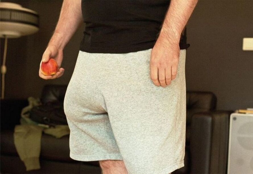 A man with an enlarged member
